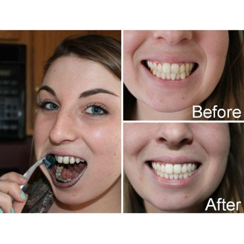 Bamboo Charcoal Teeth Tooth De - Teeth Whitening Co 评论和价格