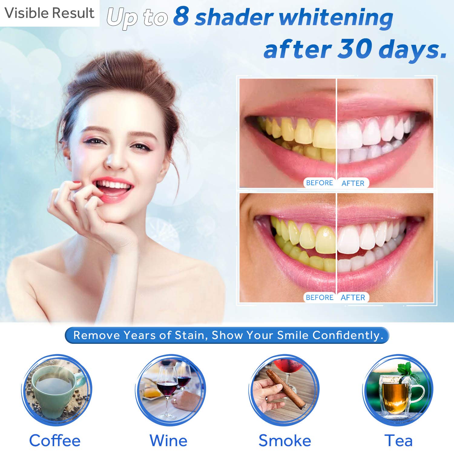Teeth Whitening Gel Refill Syr - Teeth Whitening Hydrogen Peroxide 评论和价格
