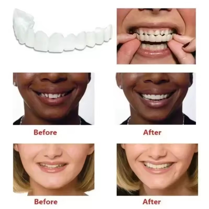 Teeth Veneers Whitening Dentur - Teeth Whitening Veneers 评论和价格