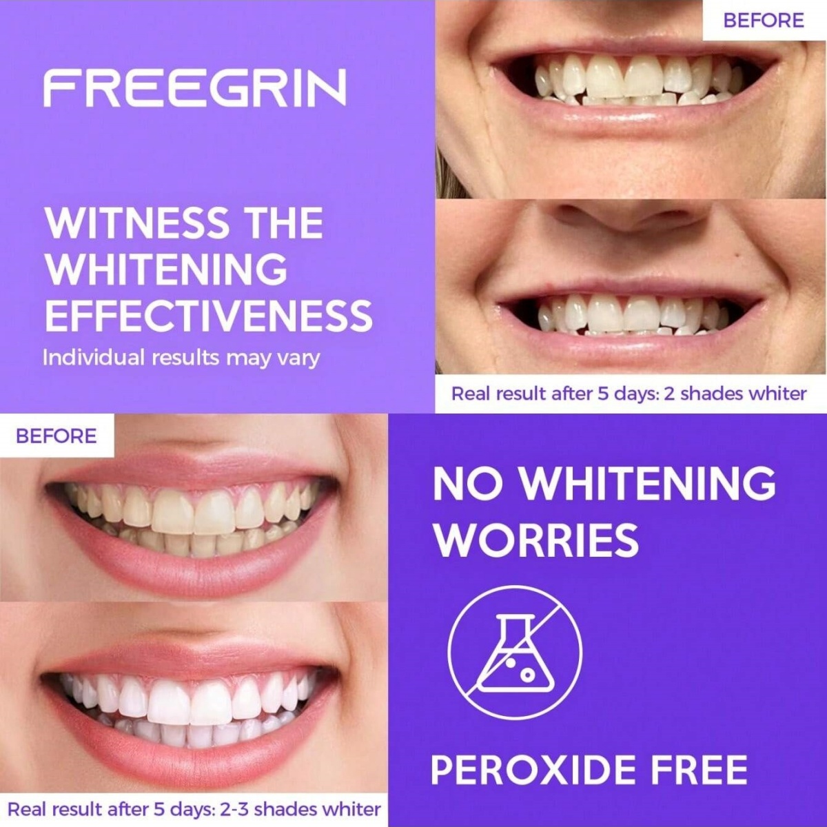 Deluxe Whitening Teeth Sticker - Teeth Whitening Hydrogen Peroxide 评论和价格