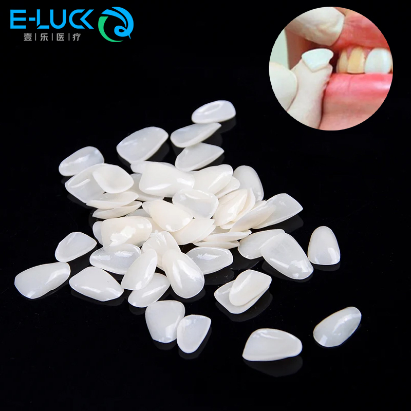 50pcs Dental Teeth Veneers Tem - Teeth Whitening Veneers 评论和价格