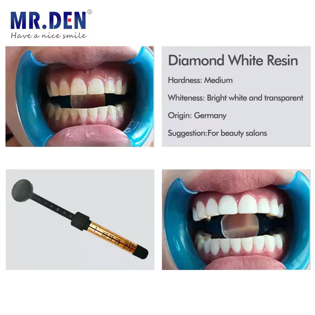 Nano Enamel Veneer Material Te - Teeth Whitening Veneers 评论和价格